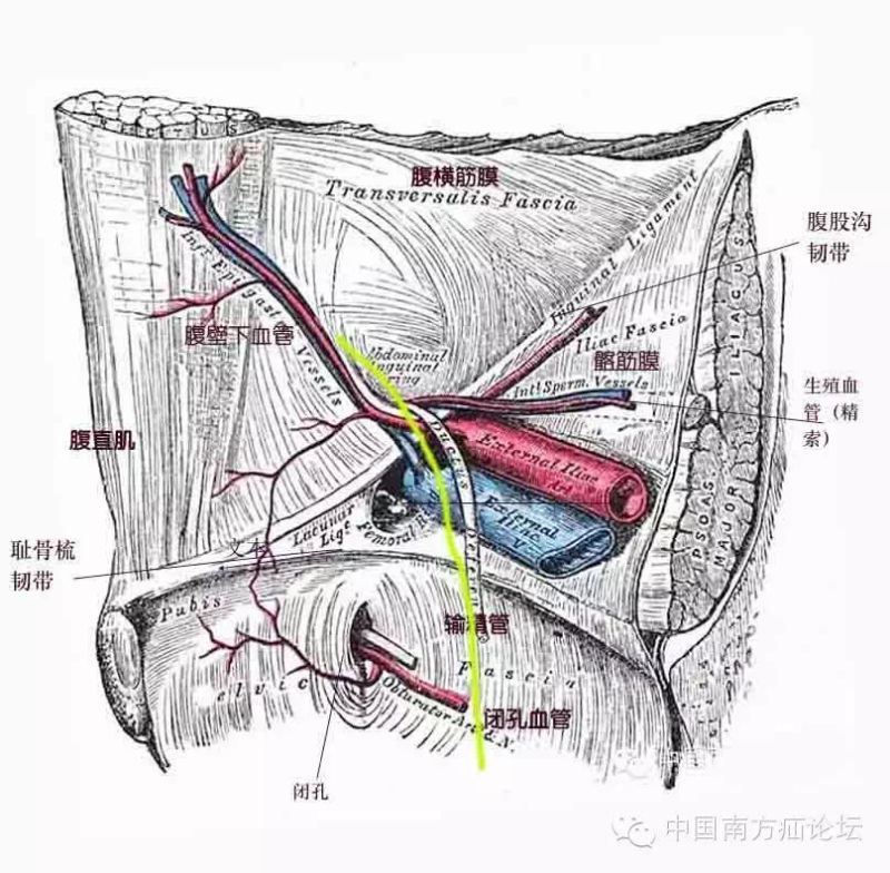 基础腔镜下腹股沟疝的解剖一