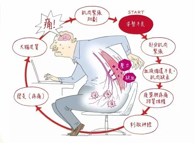 腰痛图片