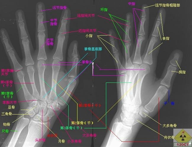 全身骨片x线详解