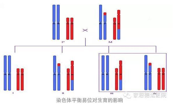 染色体易位包括平衡易位及罗氏易位.