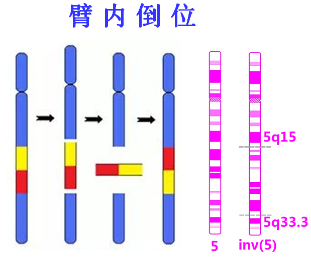 夫妻间有染色体或基因异常者的生育问题