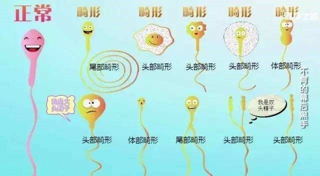 精子畸形是怎么回事,精子畸形会导致胎儿畸形吗?