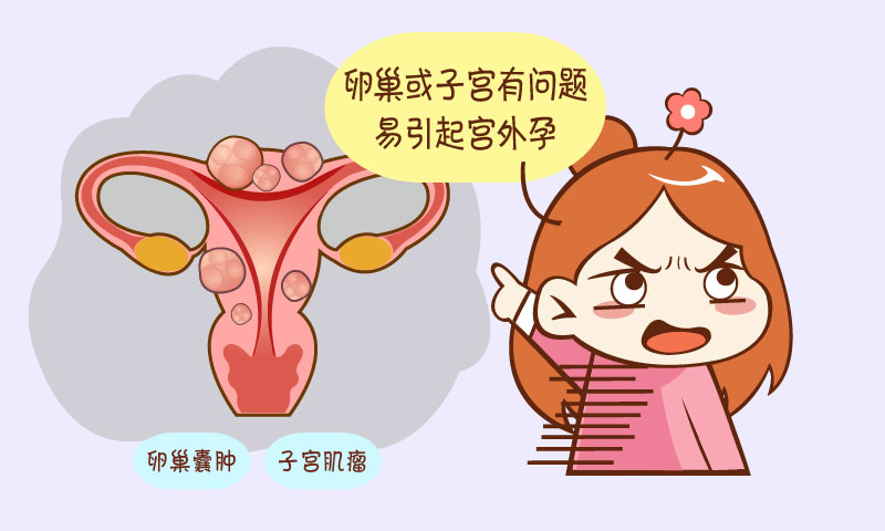 子宫肌瘤必须手术吗