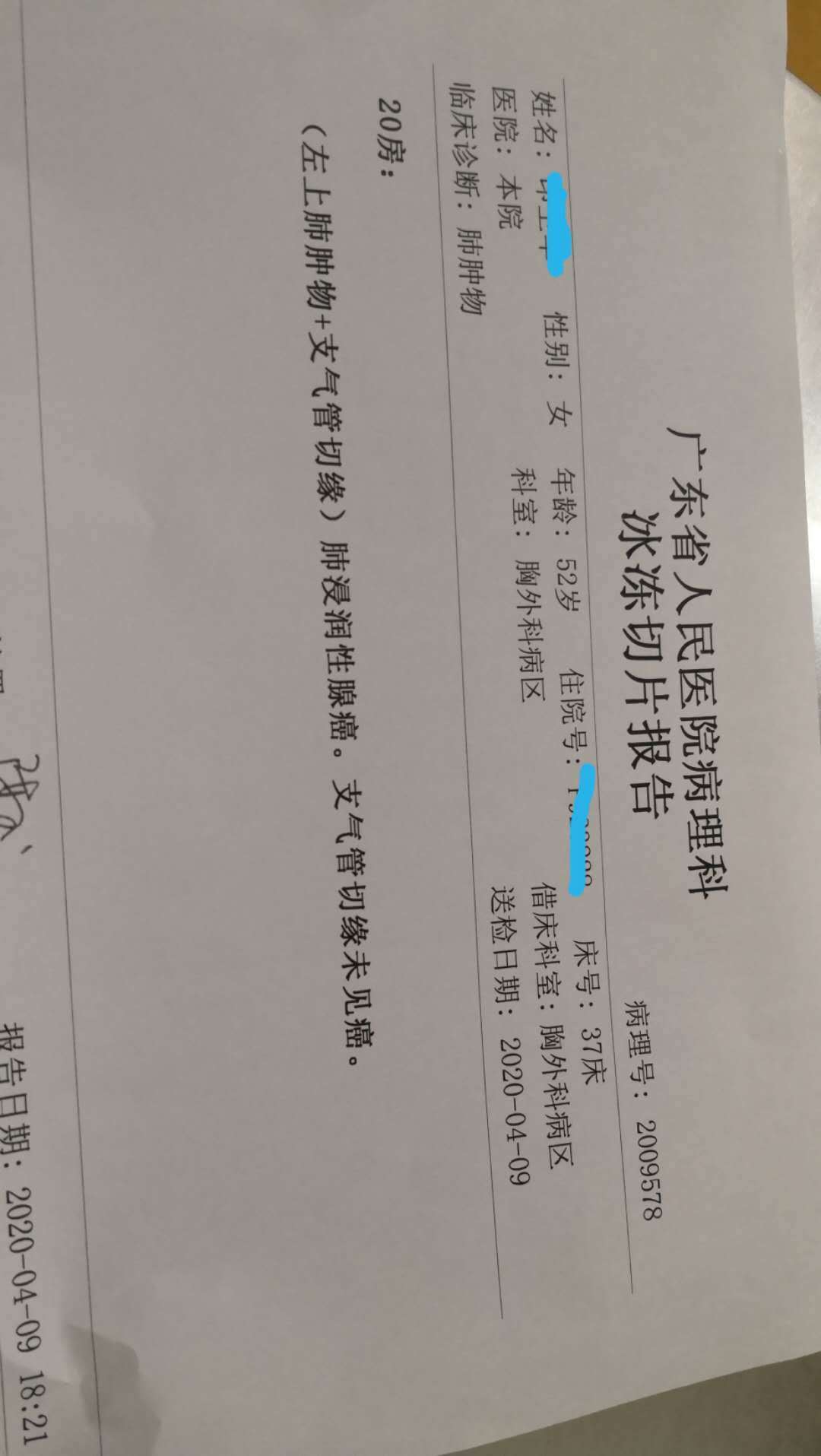 体检发现肺部小结节不必过于惊慌,建议找经验丰富的胸
