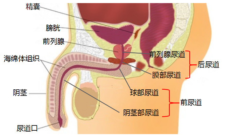 1排尿费力,尿线细,尿道狭窄尽早治!