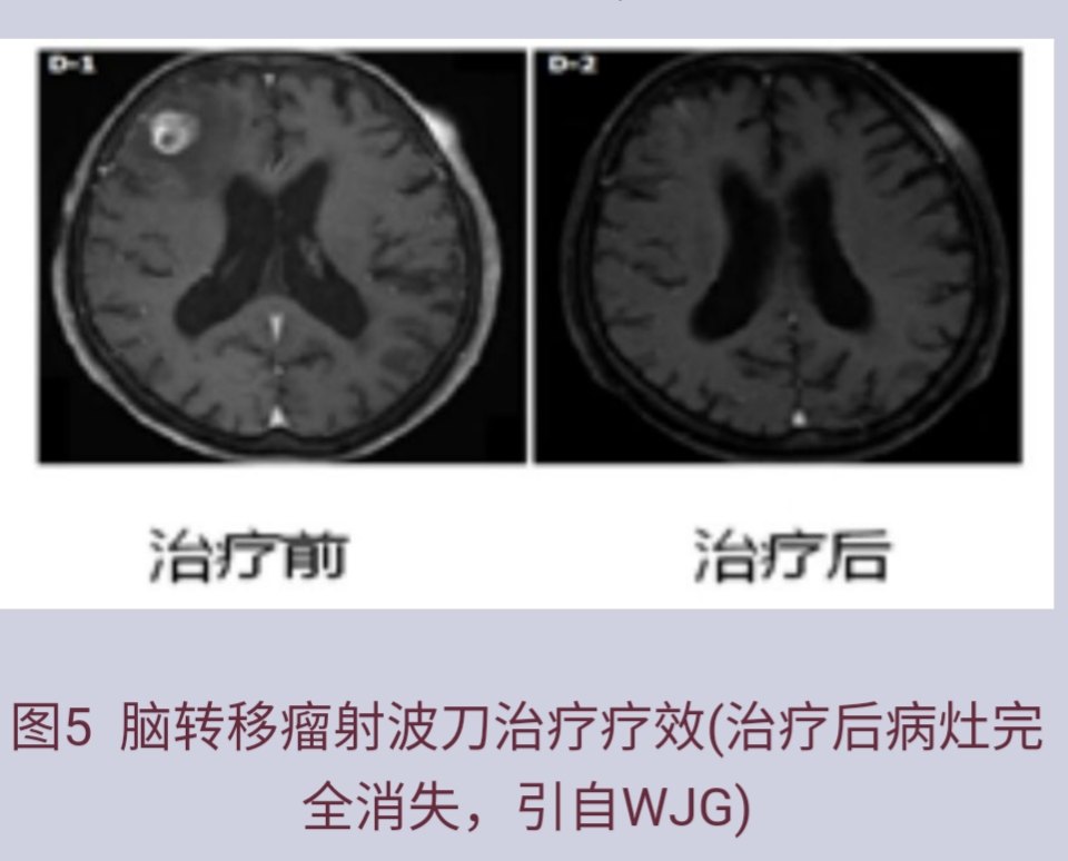 1490539835547391.jpg