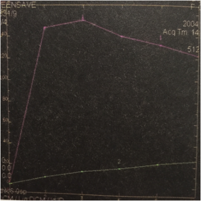 1491035100930321.png 快进快出.png