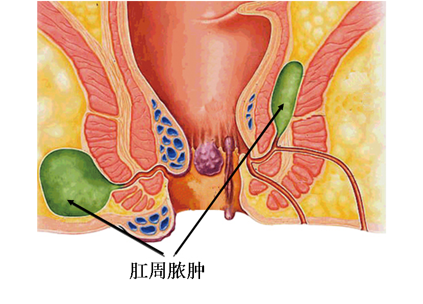 1491123208909165.png 1491123208909165.png