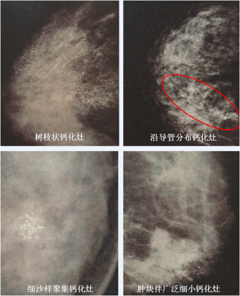 1492598448864423.png 小格式.png