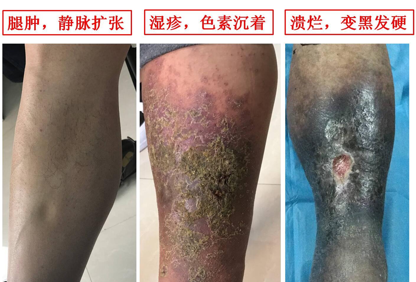 1513220550848216.jpg 表现pts.jpg