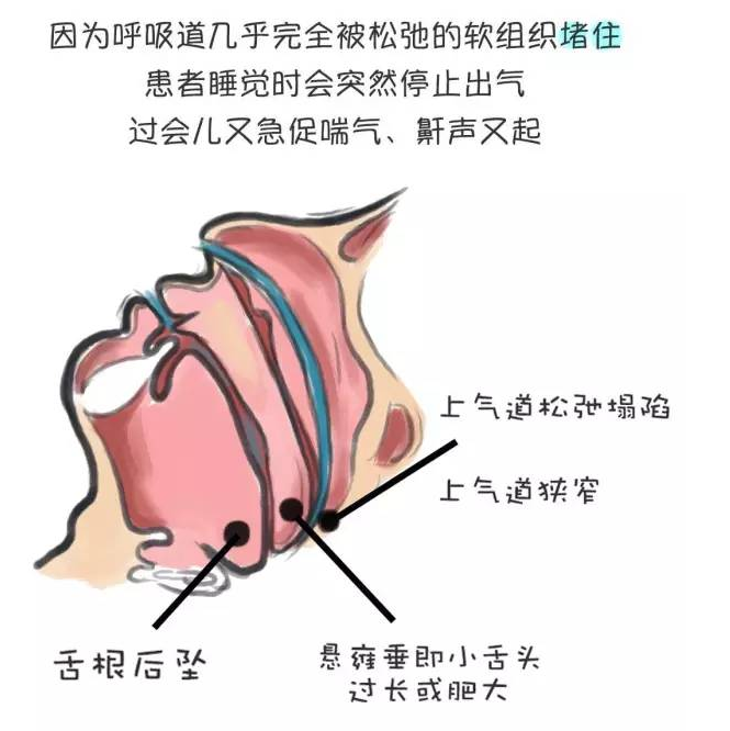 耳鼻喉科张明_耳鼻喉科医生收入(2)