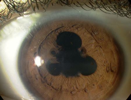 1493191623640839.jpg timg.jpg