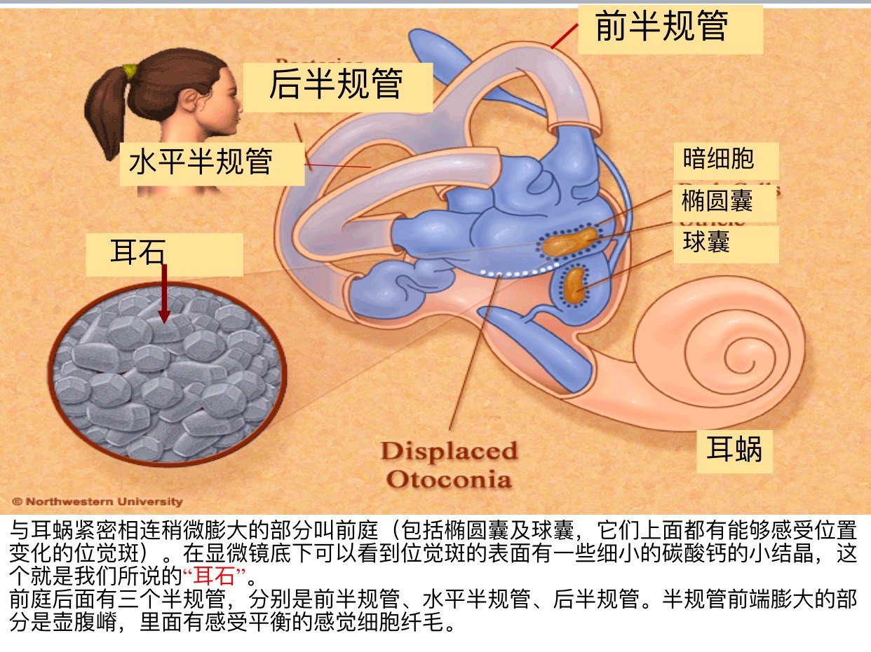 16张图片教您认识一种眩晕病~~耳石症