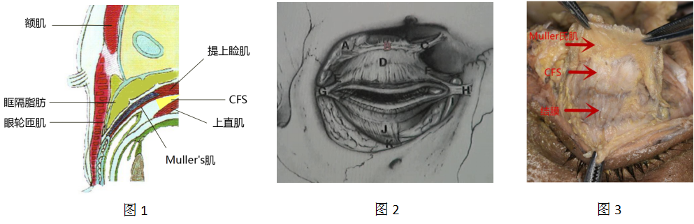 浅谈上睑下垂的手术方法