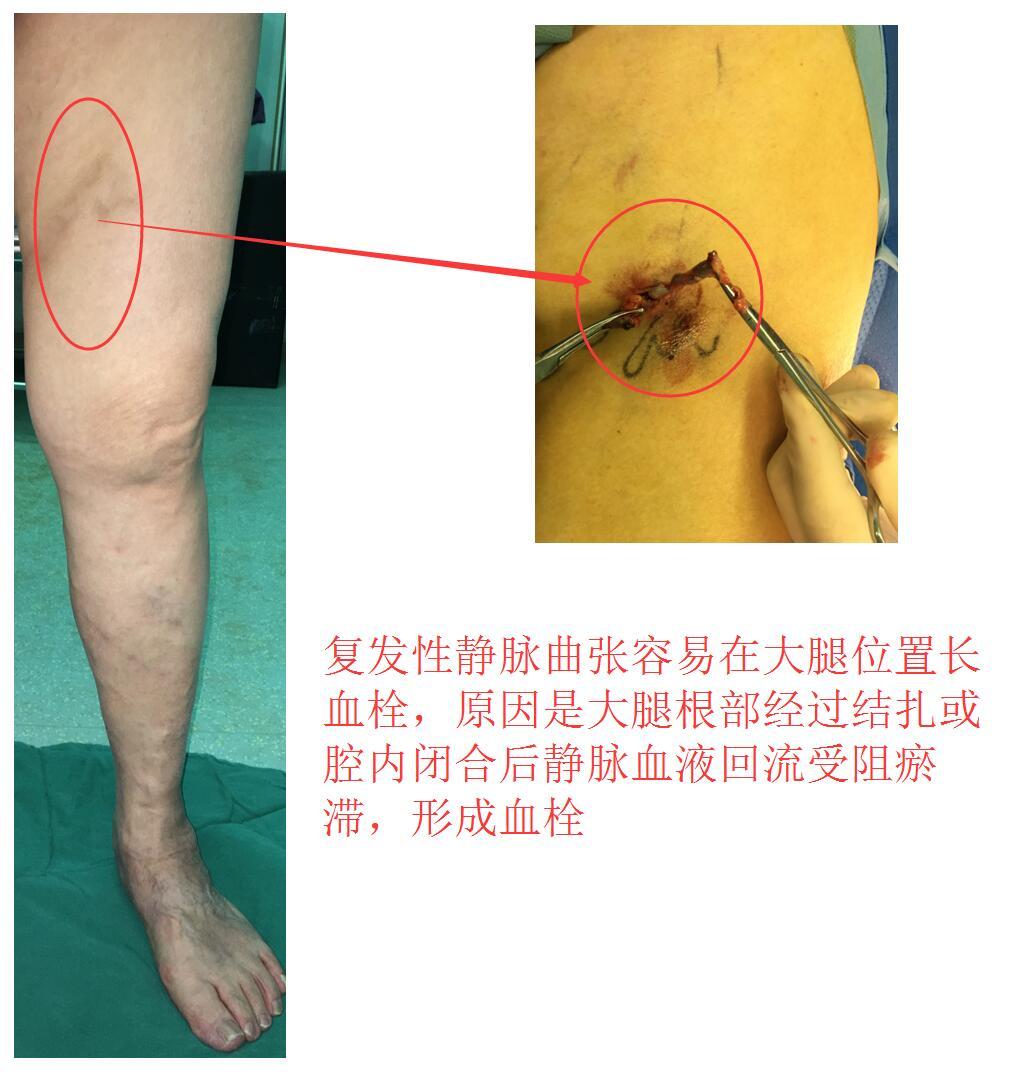 1513180413761247.jpg 复发.jpg