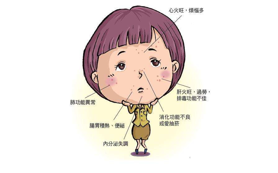 什么是痤疮?长了痤疮怎么办?