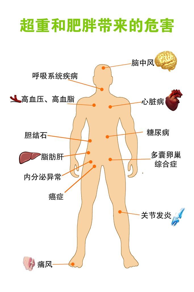 <!--HAODF:8:feipangzheng-->肥胖<!--HAODF:/8:feipangzheng-->不减肥危害大吗