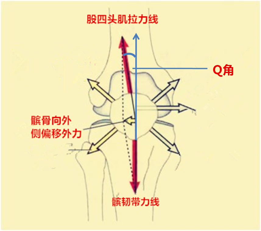 列表  q角:收缩的股四头形成拉力线将髌骨沿着向上向外侧牵引(如图)