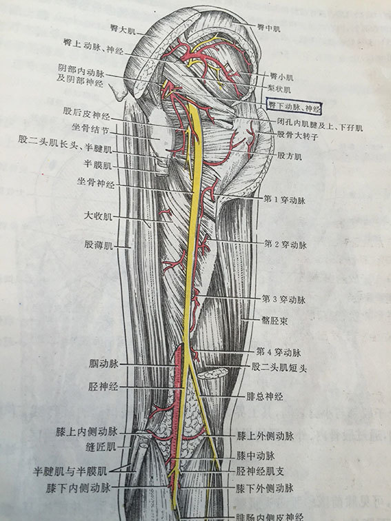 臀大肌远心端移植术再造肛门括约肌