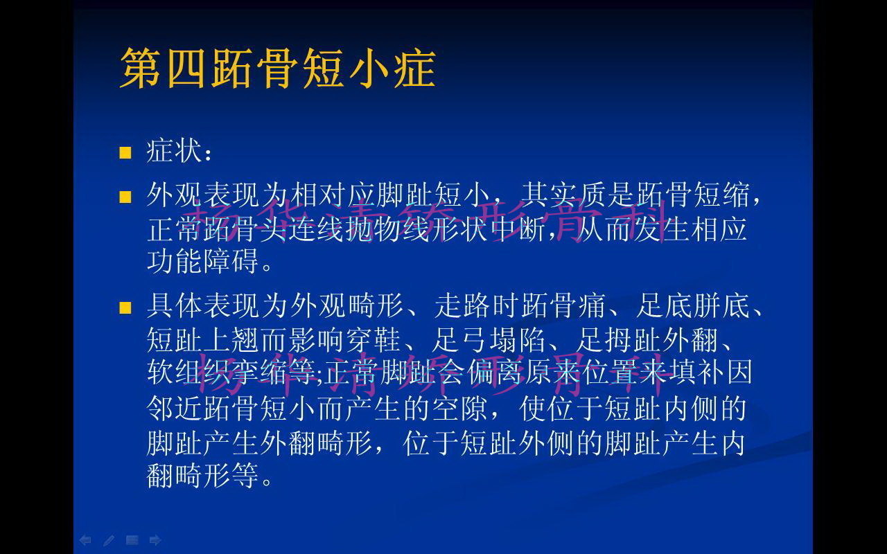 第四跖骨短小症双足典型病例