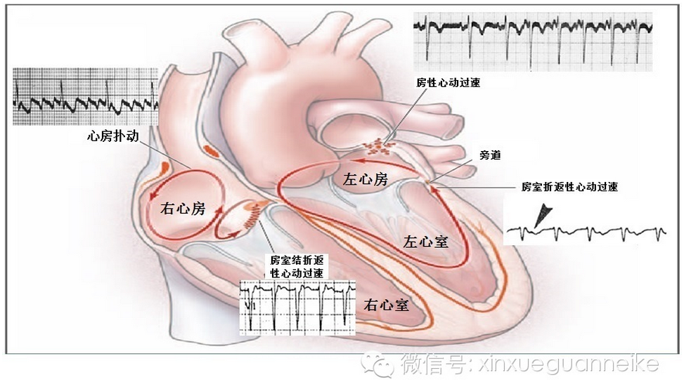 首页 疾病知识 下载客户端 浦南医院 于泓 文章列表  房室结折返性