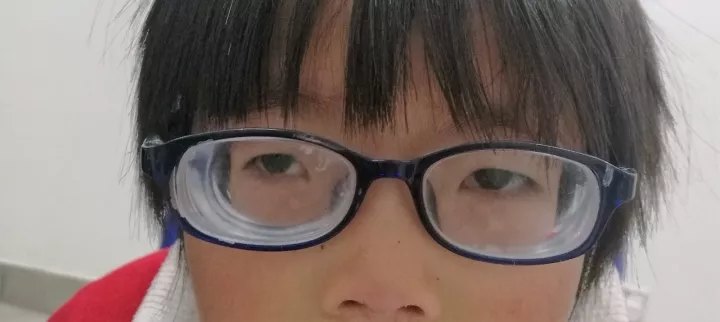 小孩子也要戴隐形眼镜?RGP和OK镜和一般的