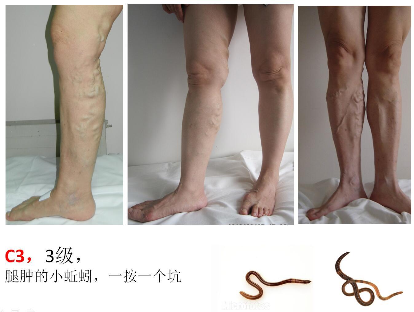 1504446043738723.jpg C3.jpg