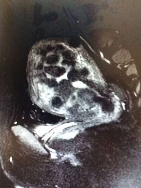 1497953100618006.png 图片.png