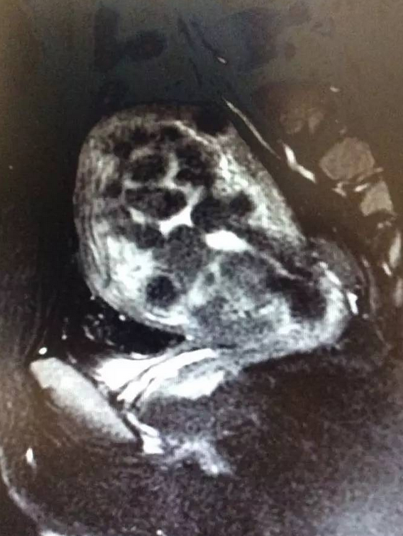 1497953060525854.png 图片.png