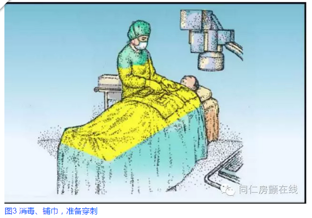 快速了解什么是房颤射频消融手术