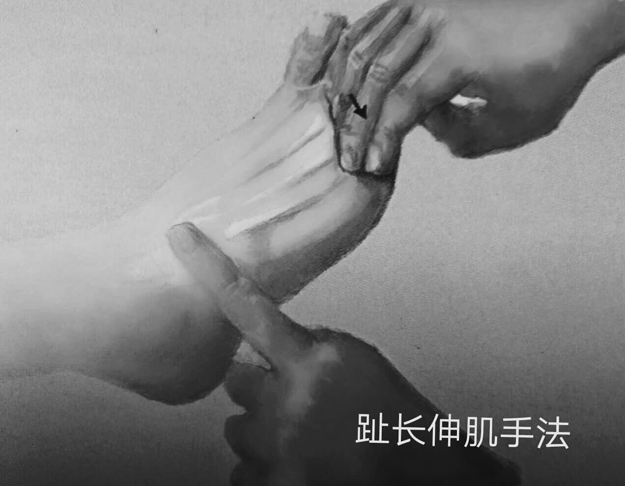 中医正骨手法系列一一