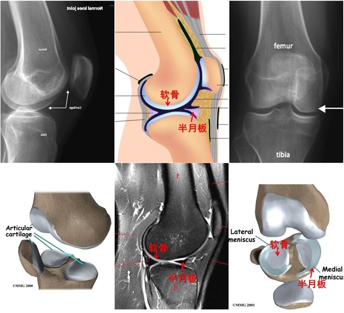 1512007324981178.jpg 1.正常的关节.jpg