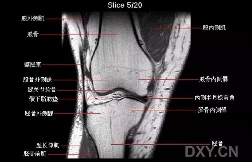 【关节影像】膝关节的磁共振（mri）解剖表现 好大夫在线