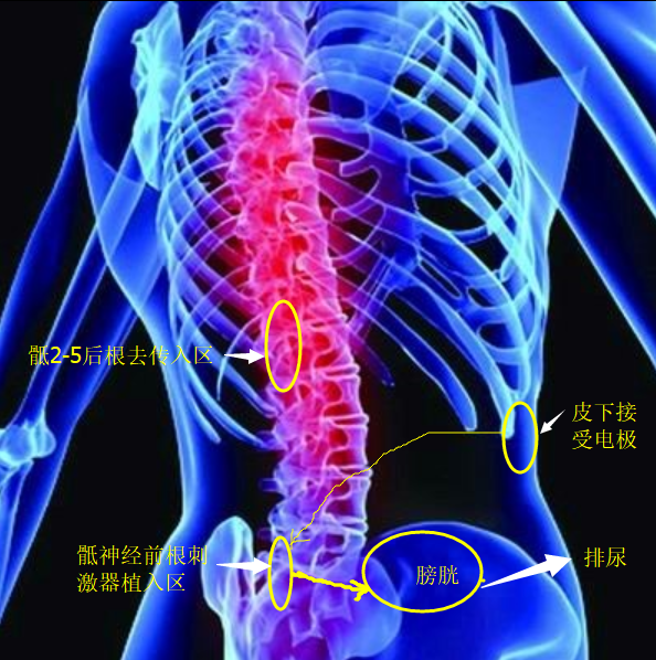 QQ截图20180115150152.png