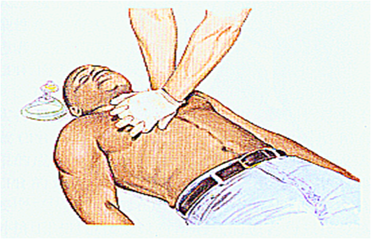 手法 和姿势 正确的部位:是双乳头连线中点(胸骨交界处并非