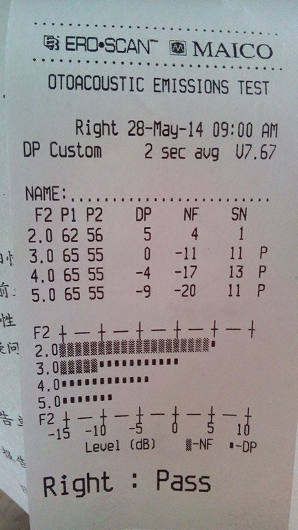 1526545822200430.jpeg