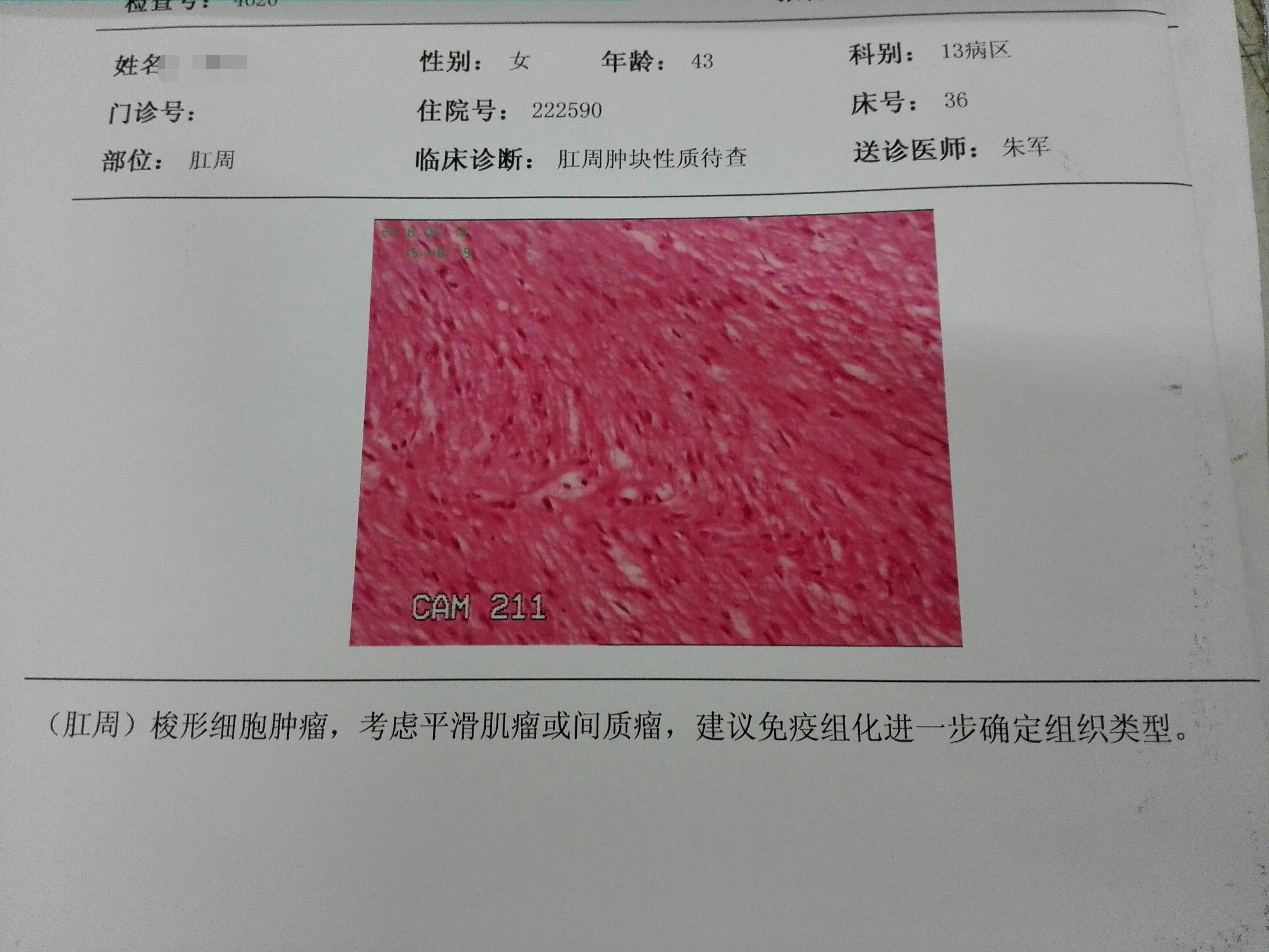 好大夫在线 蒋鑫 肛周少见病例手术  该肿块位于阴道与肛门之间,质地