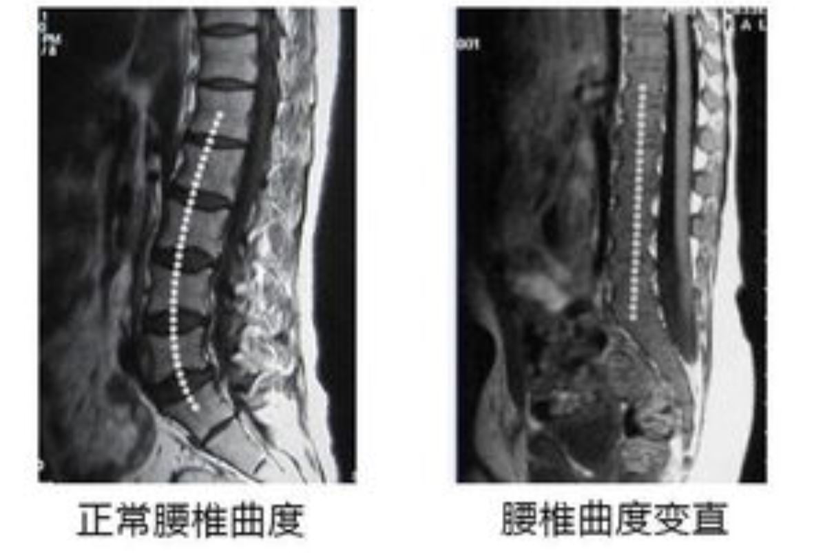 图6-11 经第2腰椎体上份的横断层-基础医学-医学