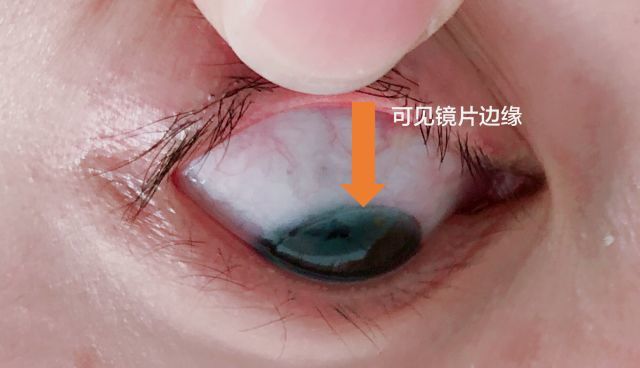 看边缘:注意黑眼珠上方是否可见镜片的边缘.