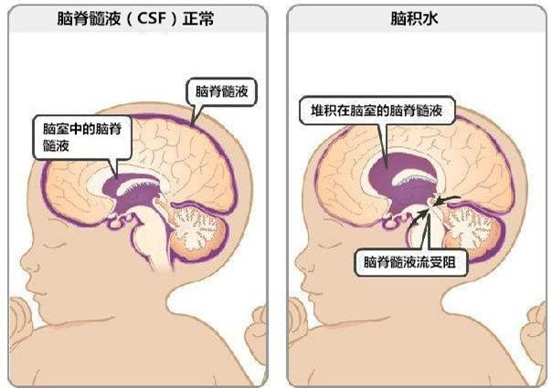 脑室模式图-2_看图王.jpg