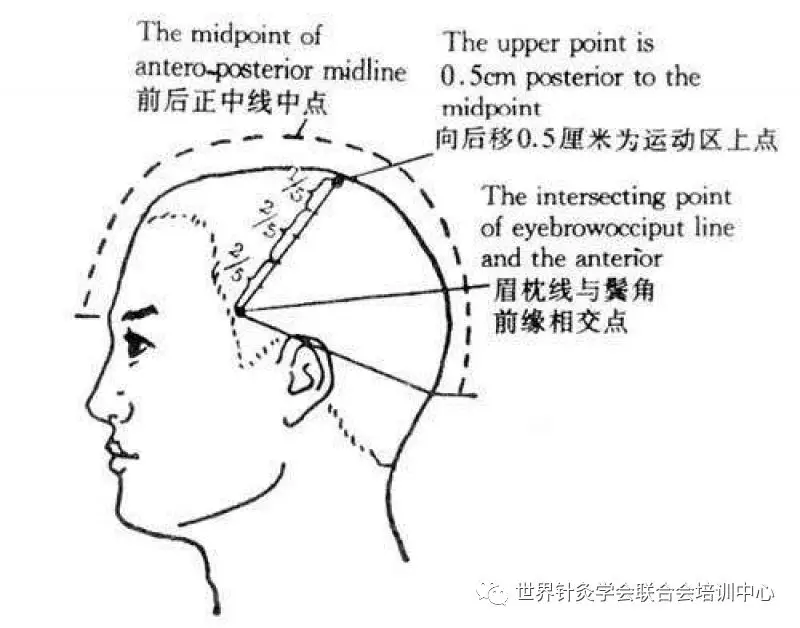 针灸名家焦顺发头针的临床研究