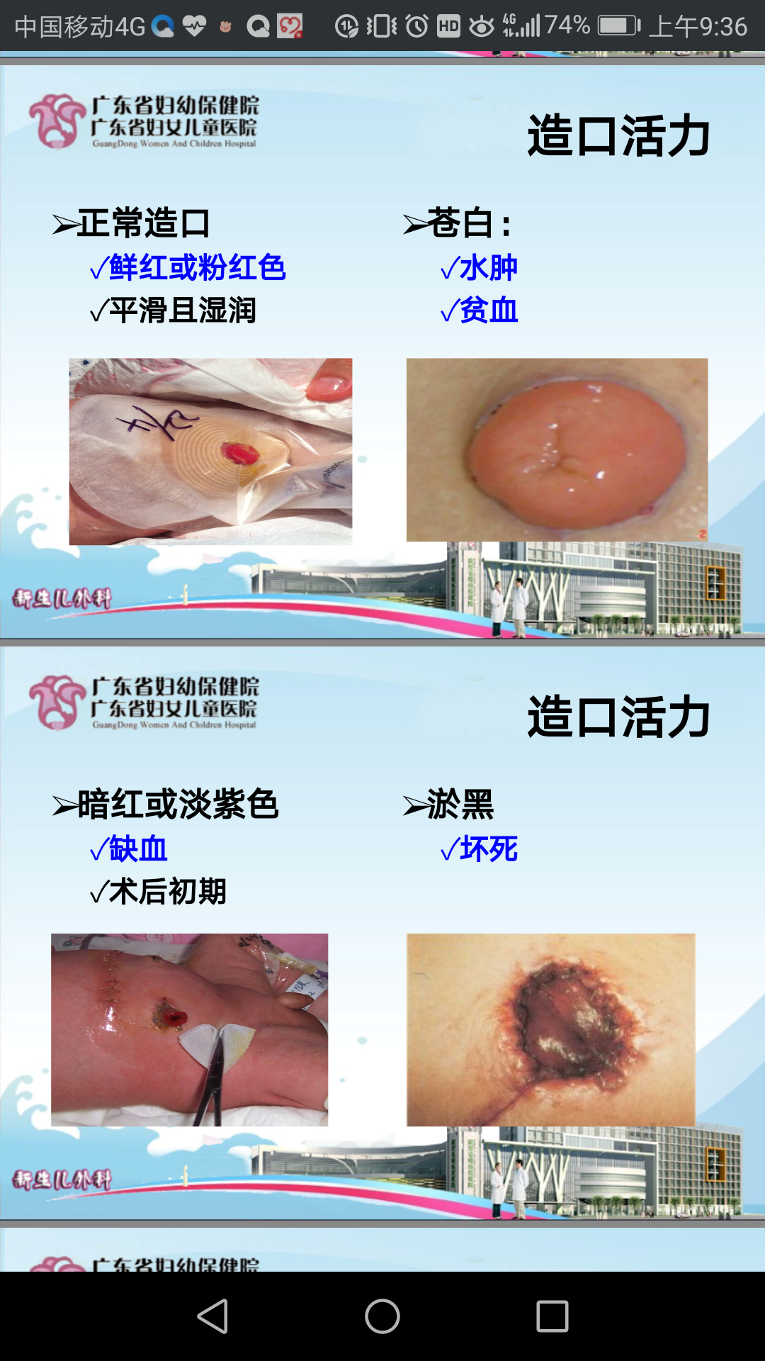 如何观察造口和更换造口袋