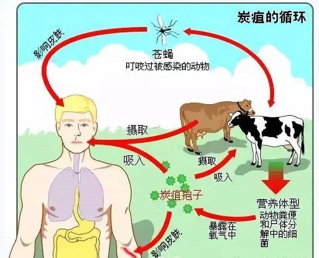 其中皮肤炭疽最为常见,占全部病例的95%以上.