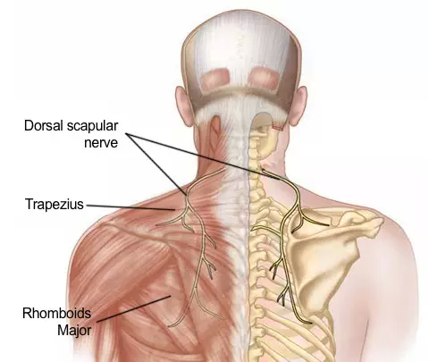 最容易忽视的颈肩背疼痛:肩胛背神经卡压综合征.