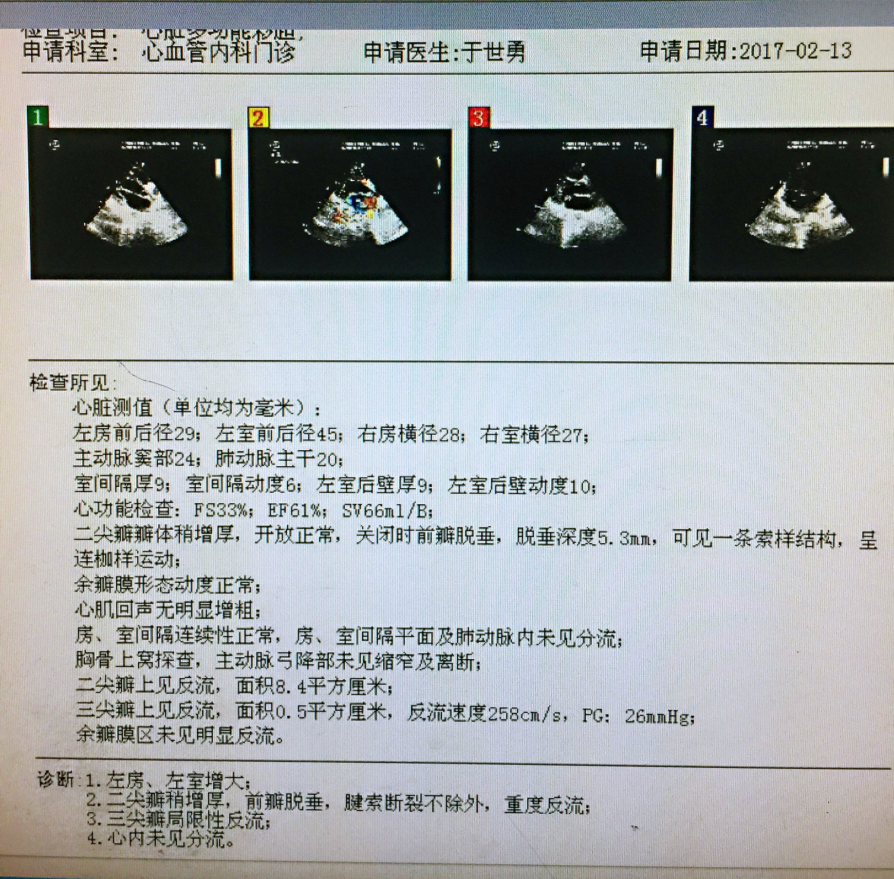 二尖瓣关闭不全是直接换瓣还是先考虑成形修复?