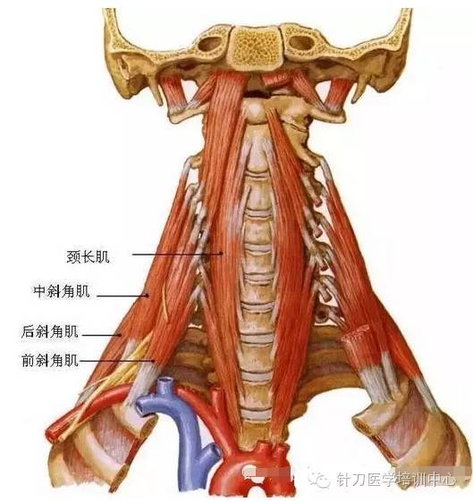 针刀治疗斜角肌慢性损伤引起神经根型颈椎病