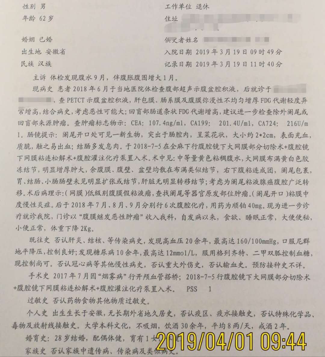 病例34腹水查因提示阑尾恶性肿瘤腹腔转移