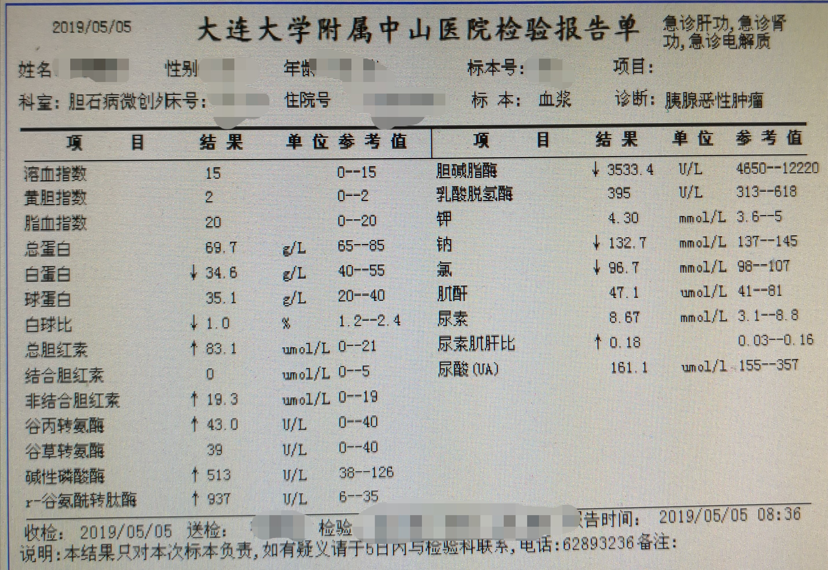 ercp治疗晚期胰腺癌导致的胆道梗阻 老年女性,胰腺癌晚期,梗阻性黄疸