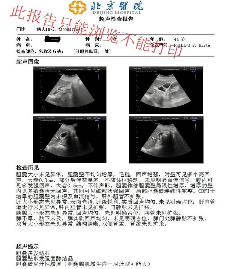 检查报告"胆囊腺肌症"是什么病?用不用治疗呢?