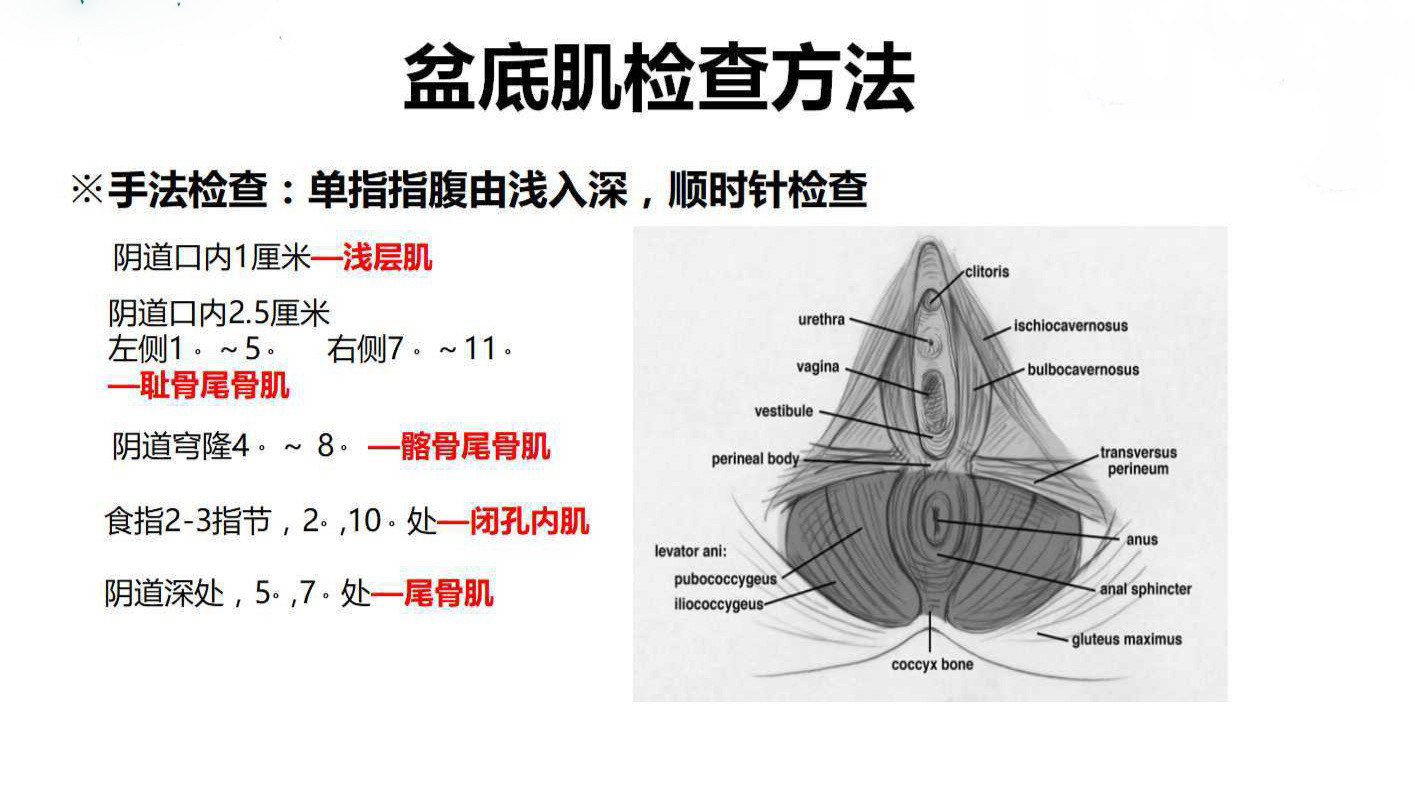 盆底肌筋膜疼痛